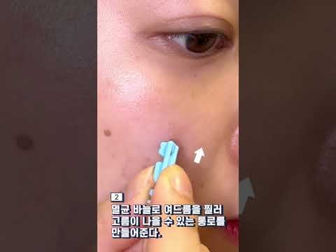 여드름 흉터 없이 짜는 법 #shorts #여드름압출 집에서 하세요‼️