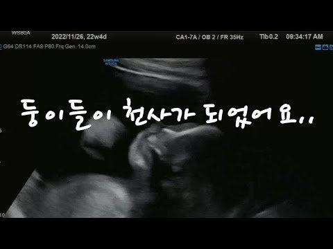 쌍둥이들이 천사가 되었어요..