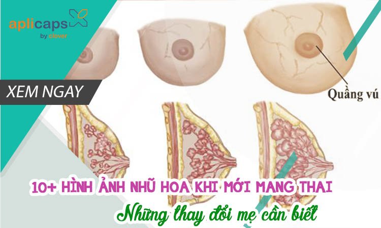 10+ hình ảnh nhũ hoa khi mới mang thai - Cập nhật tháng 6/2023 10+ Hình Ảnh Nhũ Hoa Khi Mới Mang Thai - Cập Nhật Tháng 6/2023